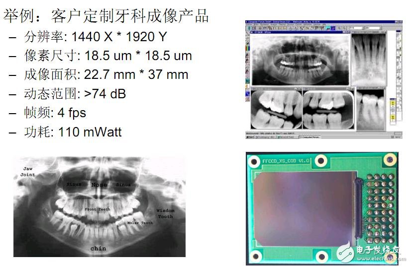 安森美半导体医疗半导体解决方案配合医疗市场发展趋势,第4张